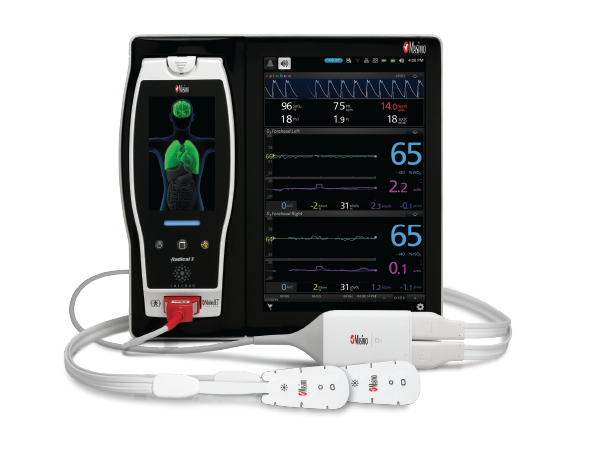 The Benefits of Masimo’s O3<sup>®</sup> Regional Oximetry - US